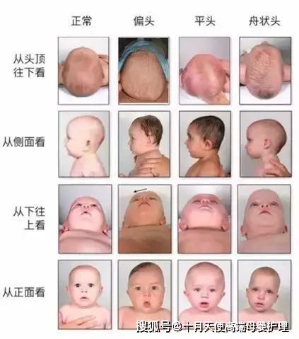 成人偏头矫正方法视频,跟随视频轻松掌握矫正方法